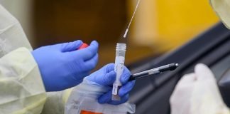 കോവിഡ് പ്രതിരോധം: സ്രവ പരിശോധന നടത്തണം