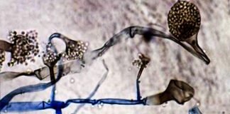 കേരളത്തിൽ 3 ജില്ലകളിൽ ബ്ലാക്ക് ഫംഗസ്, അതീവ ജാഗ്രത നിർദേശം കേരളത്തിൽ 3 ജില്ലകളിൽ ബ്ലാക്ക് ഫംഗസ്