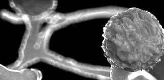 ബ്ലാക്ക് ഫംഗസ്; സംസ്ഥാനത്ത് നാല് പേര് മരിച്ചു, രണ്ടു പേർ ചികിത്സയിൽ ബ്ലാക്ക് ഫംഗസ്