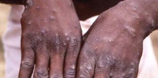 ആരോഗ്യപ്രവര്‍ത്തകരെ അറിയിച്ച് ചികിത്സതേടണം