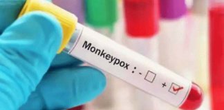 മങ്കി പോക്‌സ് ലക്ഷണങ്ങള്‍ കണ്ടെത്തി